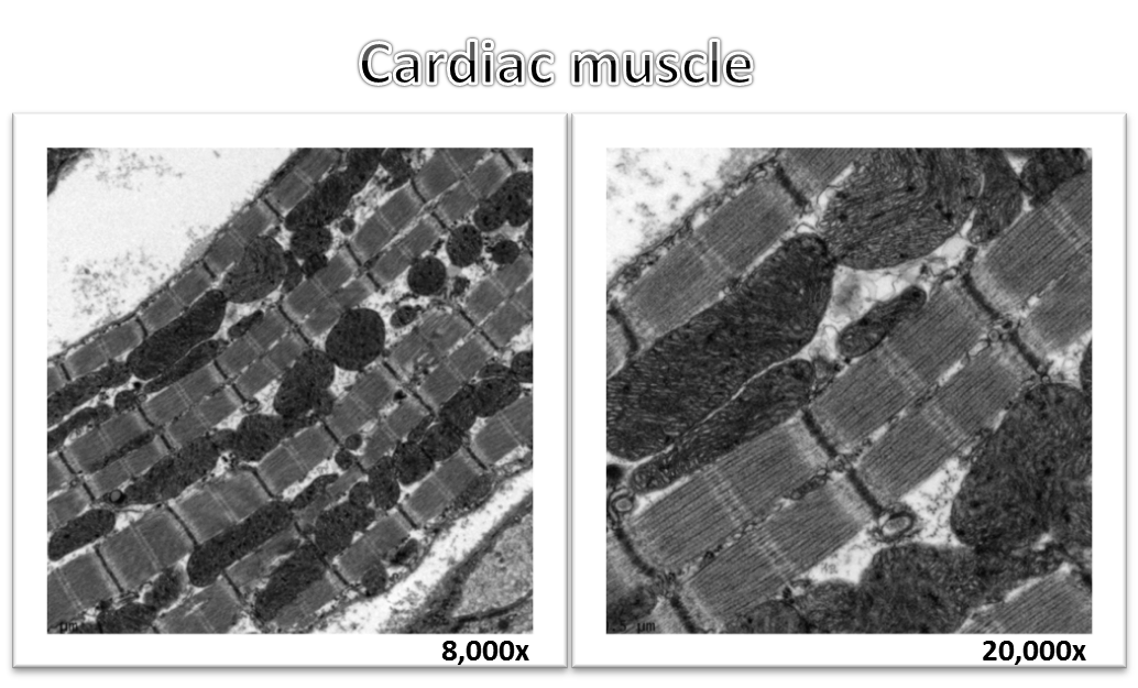 Cardiac muscle