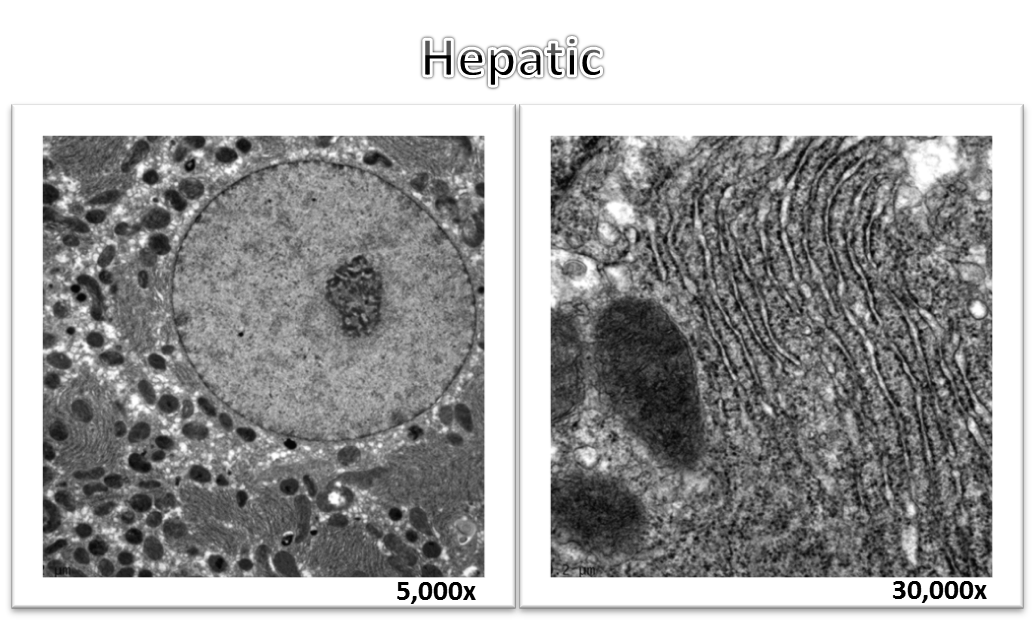 Hepatic