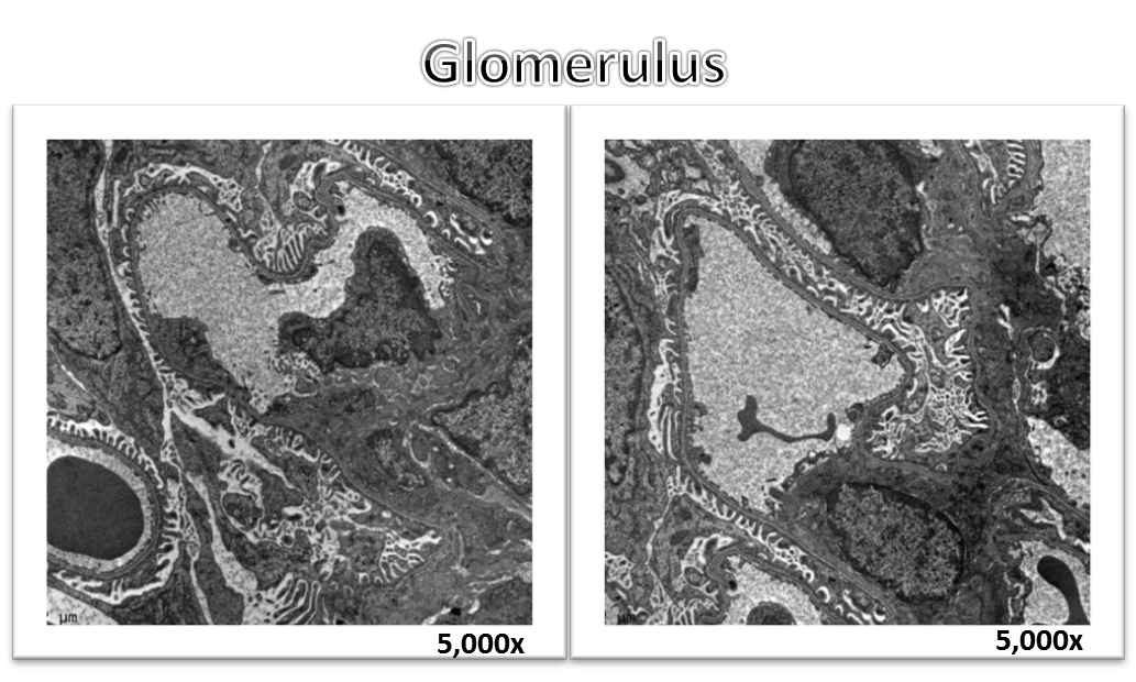 Glomerulus