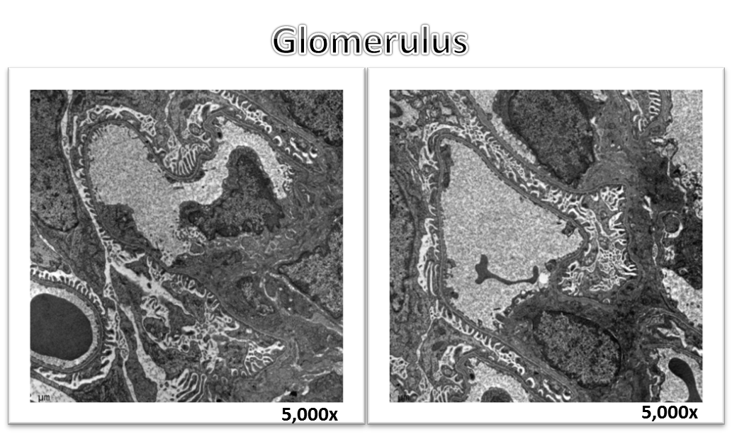 glomerulus