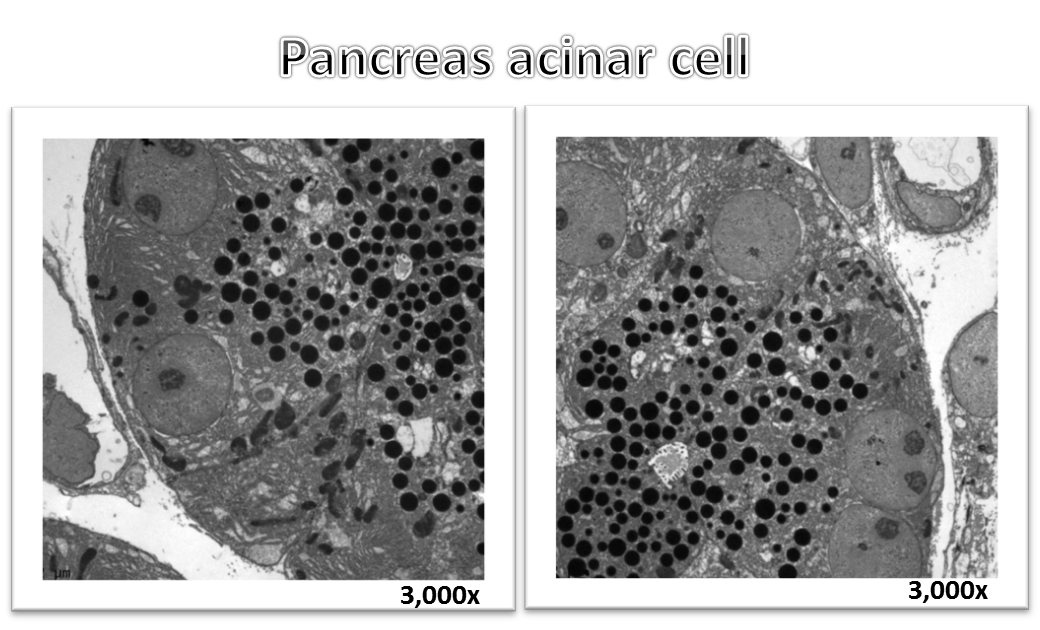 Pancreas acinar cell